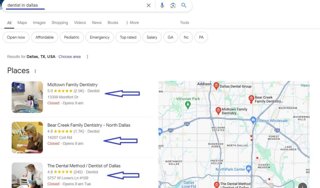 Dental Local Seo in Dallas